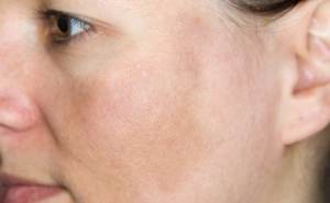 Combattere le macchie cutanee con la nuova Caudalie Vinoperfect Crème Nuit Glycolique